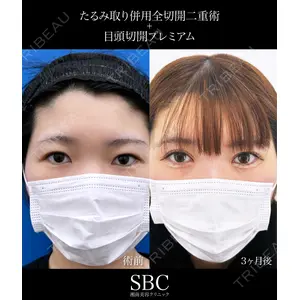 湘南美容クリニック 神戸三宮院 中川 卓医師の症例