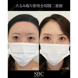 湘南美容クリニック 神戸三宮院 中川 卓医師の症例