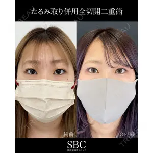 湘南美容クリニック 神戸三宮院 中川 卓医師の症例
