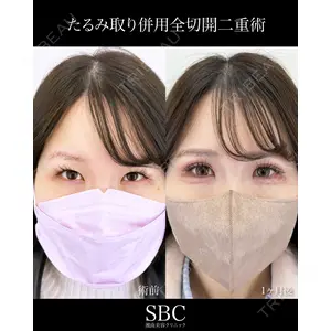 湘南美容クリニック 神戸三宮院 中川 卓医師の症例