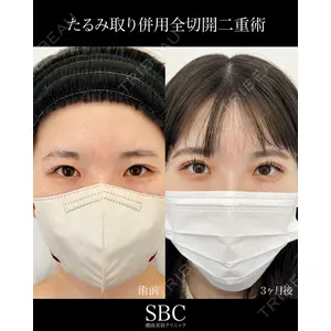 湘南美容クリニック 神戸三宮院 中川 卓医師の症例