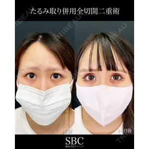 湘南美容クリニック 神戸三宮院 中川 卓医師の症例
