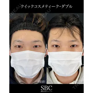 湘南美容クリニック 神戸三宮院 中川 卓医師の症例