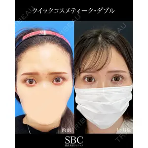 湘南美容クリニック 神戸三宮院 中川 卓医師の症例