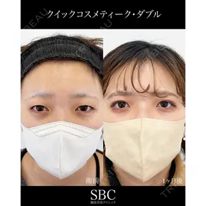 湘南美容クリニック 神戸三宮院 中川 卓医師の症例