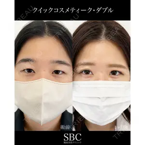 湘南美容クリニック 神戸三宮院 中川 卓医師の症例