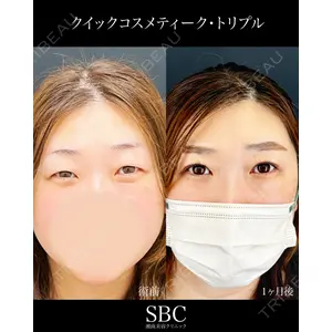 湘南美容クリニック 神戸三宮院 中川 卓医師の症例