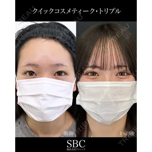 湘南美容クリニック 神戸三宮院 中川 卓医師の症例