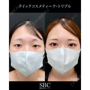 湘南美容クリニック 神戸三宮院 中川 卓医師の症例