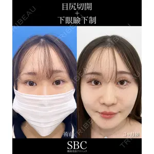 湘南美容クリニック 神戸三宮院 中川 卓医師の症例
