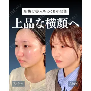 神戸美容外科 ネビュラクリニック 岩﨑 雅医師の症例