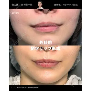 PRISM Beauty Clinic 町田院の症例