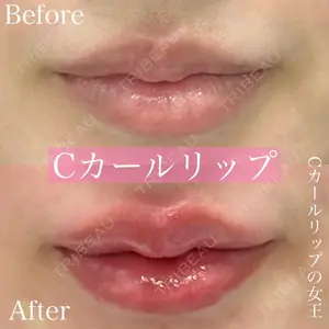 ルラ美容クリニック 渋谷本院 昼間 路子医師の症例