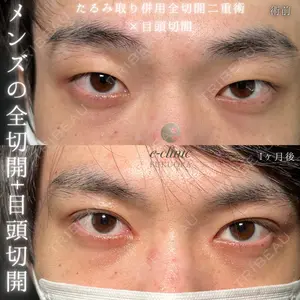 eクリニック 福岡院 伊藤 渉医師の症例