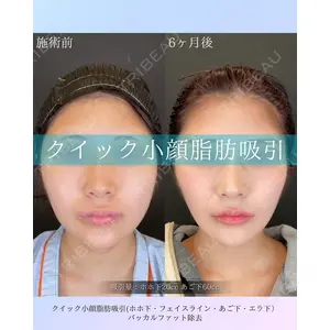 ルラ美容クリニック 札幌本院 佐藤 雄紀医師の症例