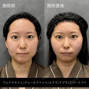 RIVER CLINIC（リバークリニック）大阪院の症例