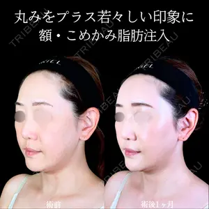 アリエル美容クリニック 郡山院 安齋 誠基医師の症例