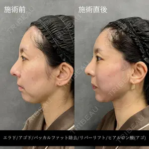 RIVER CLINIC（リバークリニック）大阪院の症例