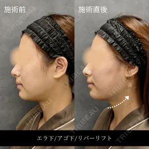 RIVER CLINIC（リバークリニック）大阪院の症例