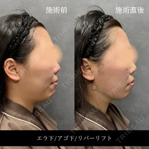 RIVER CLINIC（リバークリニック）大阪院の症例