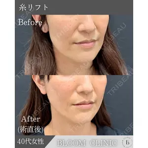 ブルームクリニック（BLOOM CLINIC） 大西 雅樹医師の症例
