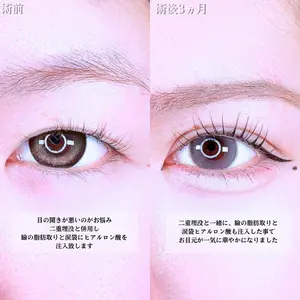 アリエル美容クリニック 水戸院 天白 典秀医師の症例