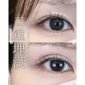 湘南美容クリニック 名古屋駅本院 高川 裕也医師の症例