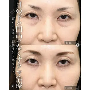 湘南美容クリニック 名古屋駅本院 高川 裕也医師の症例