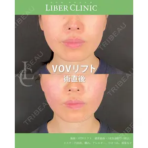 LIBER CLINIC 矢橋 洋一郎医師の症例