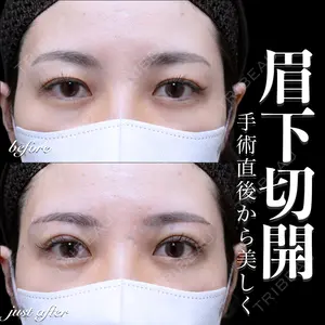 EMMO FACE CLINIC 大宮院 百瀬 直也医師の症例