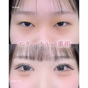ルラ美容クリニック 町田院 松岡 舟作医師の症例
