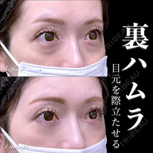 EMMO FACE CLINIC 大宮院 百瀬 直也医師の症例