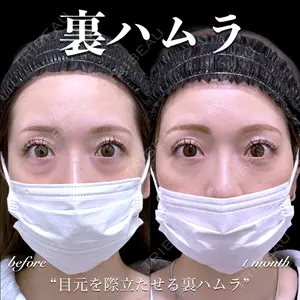EMMO FACE CLINIC 大宮院 百瀬 直也医師の症例