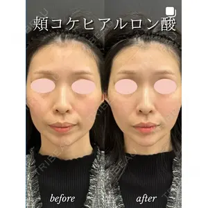 ルラ美容クリニック 札幌大通り院 能登 貴弘医師の症例