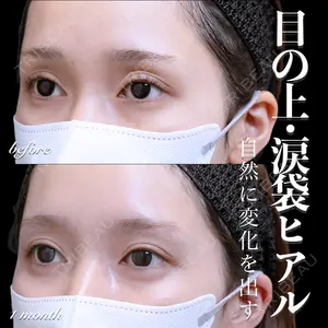 EMMO FACE CLINIC 大宮院 百瀬 直也医師の症例