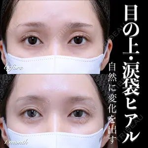 EMMO FACE CLINIC 大宮院 百瀬 直也医師の症例