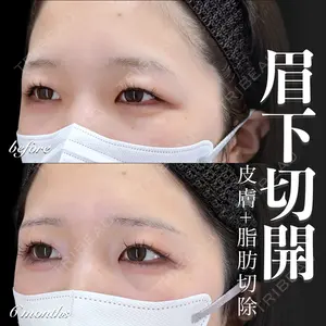 EMMO FACE CLINIC 大宮院 百瀬 直也医師の症例