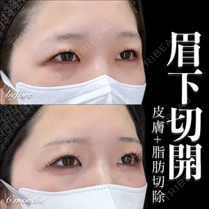 EMMO FACE CLINIC 大宮院 百瀬 直也医師の症例