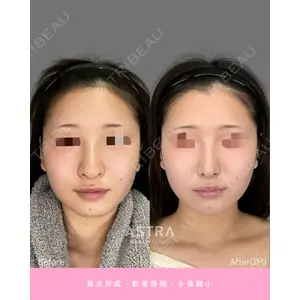 ASTRA BEAUTY CLINIC 河口 はるか医師の症例