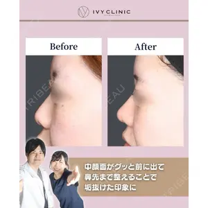 千葉美容外科アイビークリニックの症例