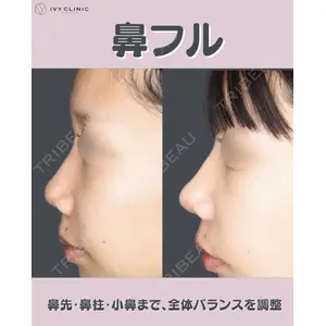 千葉美容外科アイビークリニックの症例