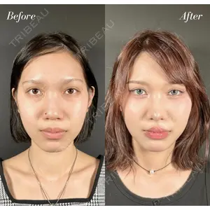R Beauty CLINIC 名古屋院 木村 尚大医師の症例