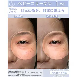 聖心美容クリニック 六本木院 佐藤 航司医師の症例