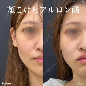 ルラ美容クリニック 名古屋栄院 / ルラスキンクリニック 名古屋栄院 関戸 優医師の症例