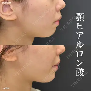 ルラ美容クリニック 名古屋栄院 / ルラスキンクリニック 名古屋栄院 関戸 優医師の症例