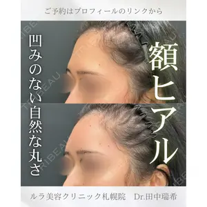ルラ美容クリニック 札幌本院 田中 瑞希医師の症例