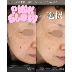 muni skin clinicの症例