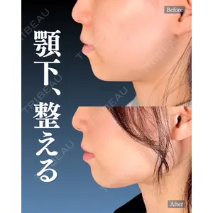 神戸美容外科 ネビュラクリニック 岩﨑 雅医師の症例