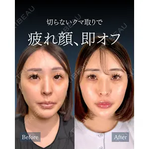 神戸美容外科 ネビュラクリニック 岩﨑 雅医師の症例