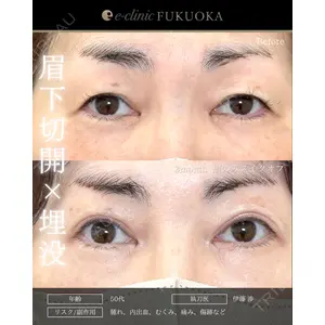 eクリニック 福岡院 伊藤 渉医師の症例